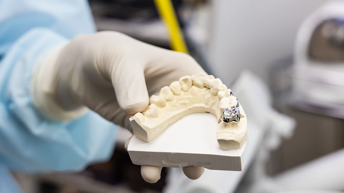 How to Prevent Dental Caries